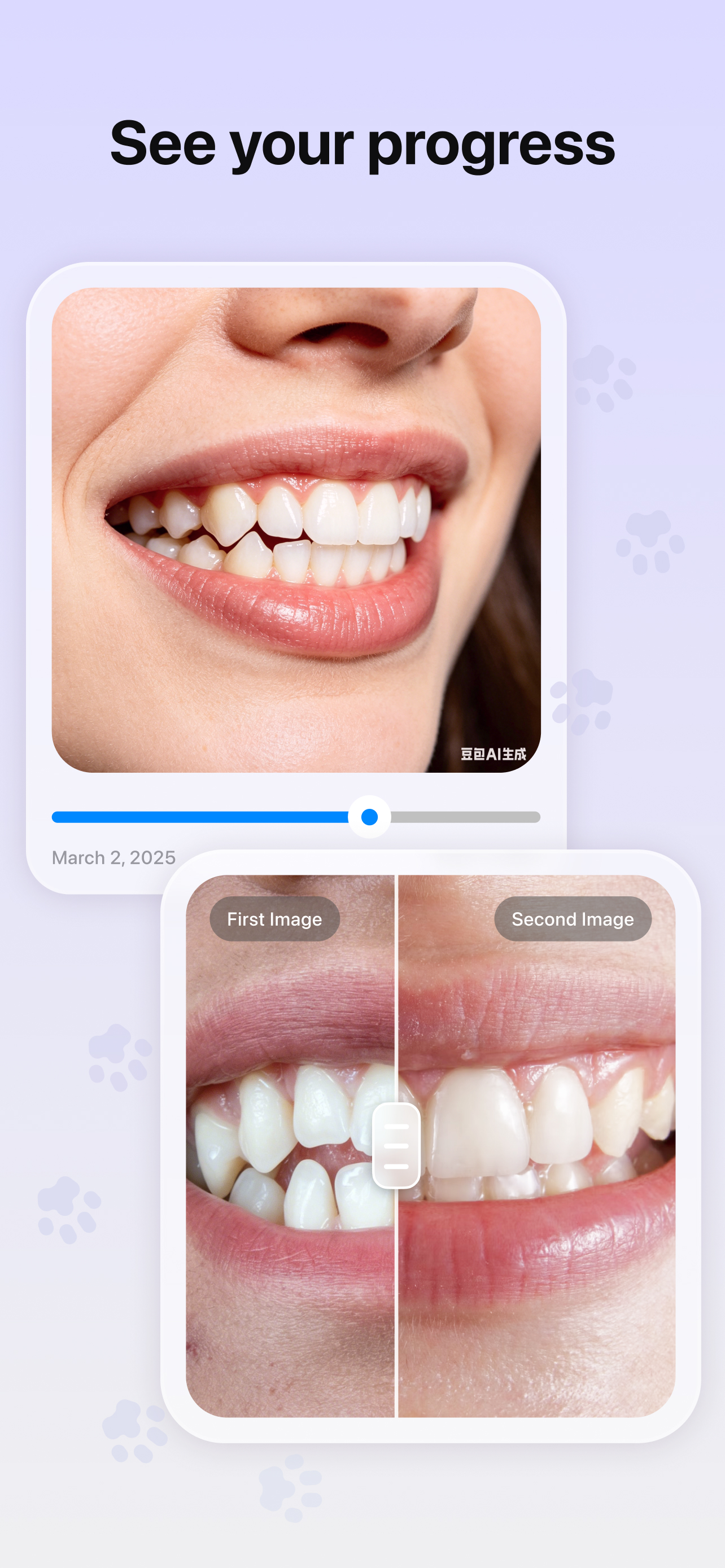 BraceTime progress comparison screen